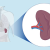People with extra spleen